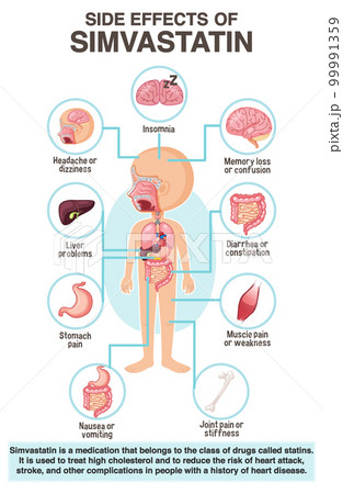 Human anatomy diagram cartoon style of simvastatin side effects 99991359