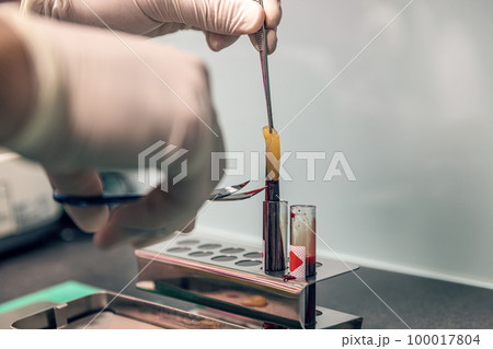 Platelet-rich fibrin application 100017804