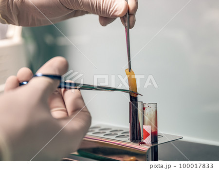 Platelet Rich Fibrin Platelet Rich Fibrin 100017833