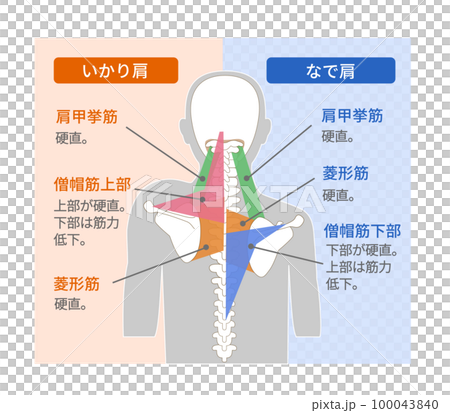 いかり肩となで肩の筋肉の構造 いかり肩となで肩の筋肉の構造 100043840