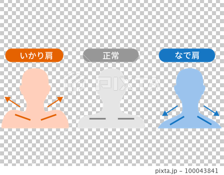 碇肩和斜肩的區別 碇肩和斜肩的區別 100043841