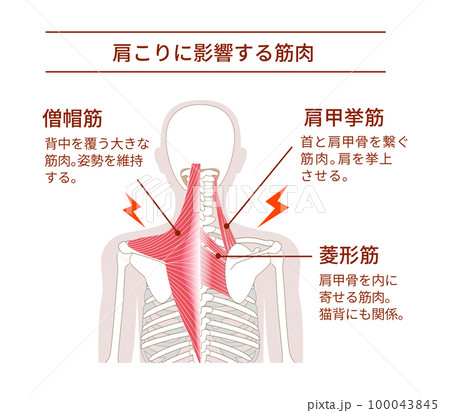 肩こりの原因となる背中の筋肉 肩こりの原因となる背中の筋肉 100043845