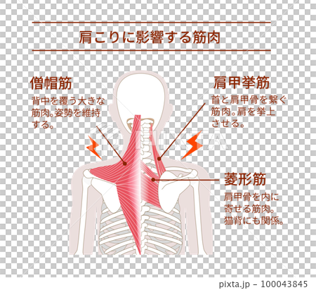 肩こりの原因となる背中の筋肉 肩こりの原因となる背中の筋肉 100043845