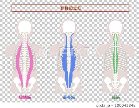 脊柱起立筋; 腸肋筋,最長筋,棘筋の解剖学筋肉イラスト 脊柱起立筋; 腸肋筋,最長筋,棘筋の解剖学筋肉イラスト 100043848