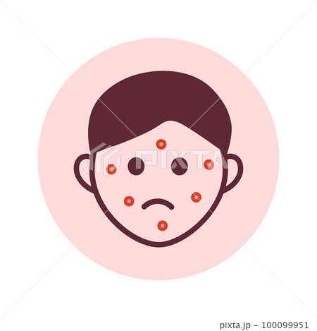 Rash on face line icon. Person suffering from pimples, acne, rash, allergy, psoriasis, eczema. Facial dermatitis. 100099951