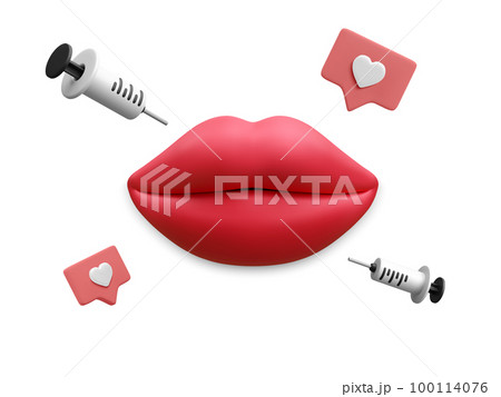 3d realistic banner for lip injection. Concept of dermatology and cosmetology treatment. Red aesthetic beautiful lips with medical plastic syringe with cosmetic injection in cartoon style 100114076
