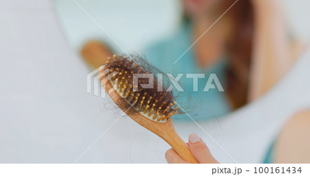 hair loss problem concept 100161434