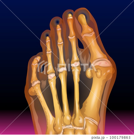 Foot Claw Bones 100179863