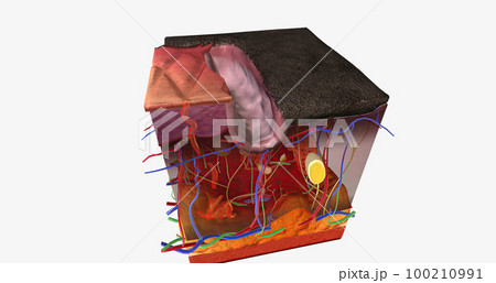 The Calciphylaxis in the Skin 100210991