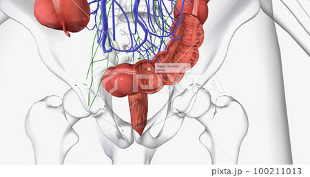 Colorectal cancer (CRC) is a common colon or rectal cancer that affects many patients over middle age. 100211013