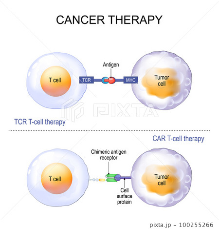 T-cell therapy with T-cell receptor (TCR) or Chimeric antigen receptor (CAR). 100255266