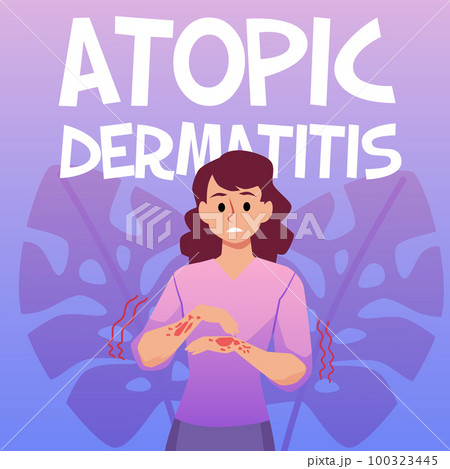 Squared banner about atopic dermatitis flat style, vector illustration Squared banner about atopic dermatitis flat style, vector illustration 100323445