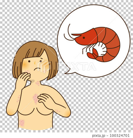 A woman who is itchy due to shrimp allergy 100324701