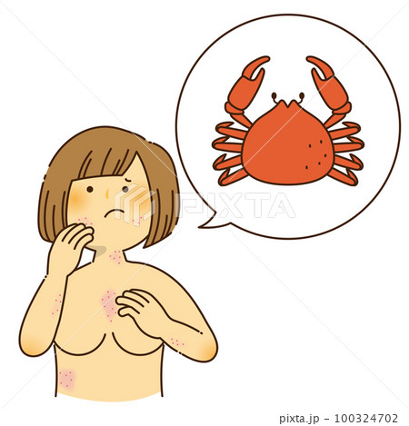 カニのアレルギーでかゆみが出ている女性 カニのアレルギーでかゆみが出ている女性 100324702