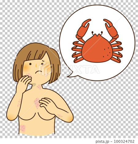 A woman who is itchy due to a crab allergy A woman who is itchy due to a crab allergy 100324702
