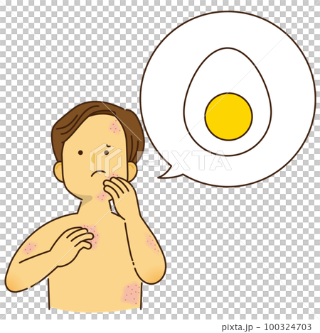 因雞蛋過敏而瘙癢的女性 100324703