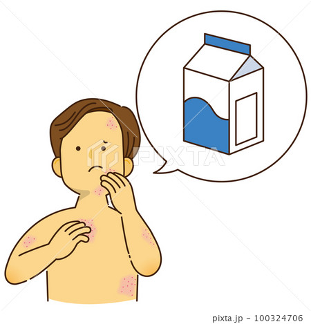 牛乳のアレルギーでかゆみが出ている男性 100324706