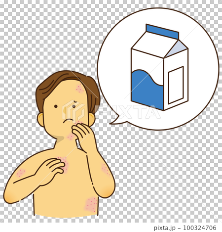 A man who is itching due to milk allergy 100324706
