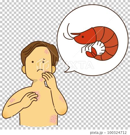 エビのアレルギーでかゆみが出ている男性 エビのアレルギーでかゆみが出ている男性 100324712