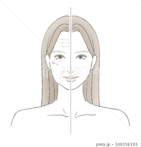 お肌の老化した女性と美しい肌の女性の比較 美容イメージイラスト 100356193
