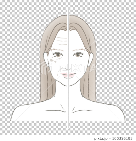 お肌の老化した女性と美しい肌の女性の比較 美容イメージイラスト 100356193