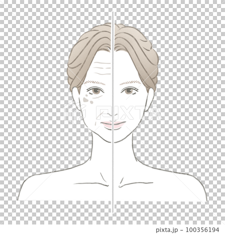 若い綺麗な肌と加齢サインの出たお肌の対比 美容イメージイラスト 100356194
