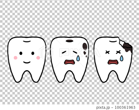 健康な歯と虫歯のキャラクターのイラスト 健康な歯と虫歯のキャラクターのイラスト 100361963