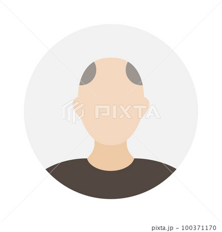 Empty face icon avatar with bald patch. Vector illustration. 100371170