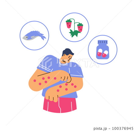 Upset man having allergy rash on hands flat style, vector illustration Upset man having allergy rash on hands flat style, vector illustration 100376945
