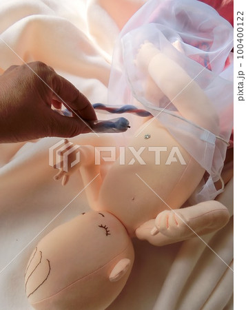へその緒を切る 赤ちゃん誕生 へその緒を切る 赤ちゃん誕生 100400122