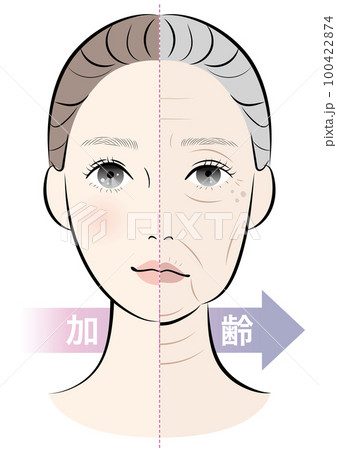 若い女性と老化が進んだ女性の顔の比較 若い女性と老化が進んだ女性の顔の比較 100422874