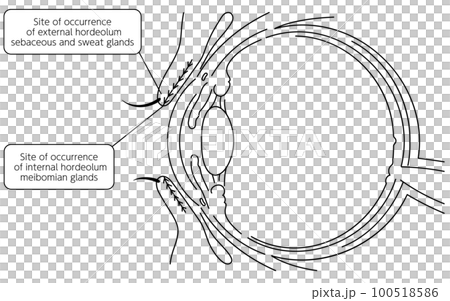 医療イラスト、眼病・ものもらいの発生部についての解剖図 100518586