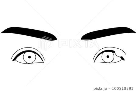 医療イラスト、眼病・ものもらい（霰粒腫）の線画イラスト 100518593