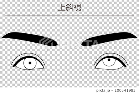医療イラスト、眼病・斜視　上斜視の図解線画イラスト 100541983