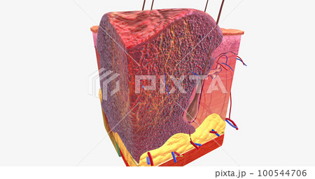Basal Cell Carcinoma in Tissue, Stage III 100544706