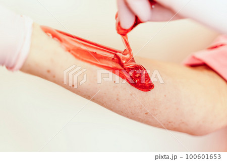 Shugaring master applying thick sugar paste on lady's hand, removing unwanted hair. Hair removal with a special sugar paste has many advantages over wax depilation Shugaring master applying thick sugar paste on lady's hand, removing unwanted hair. Hair removal with a special sugar paste has many advantages over wax depilation 100601653