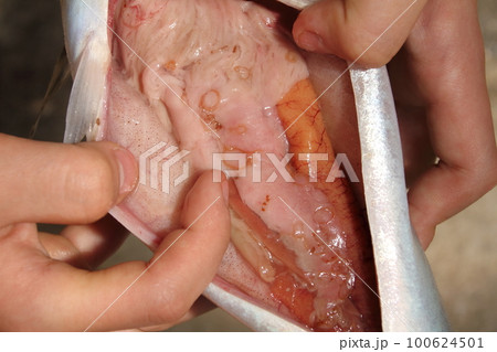 サバに寄生したアニサキス サバに寄生したアニサキス 100624501