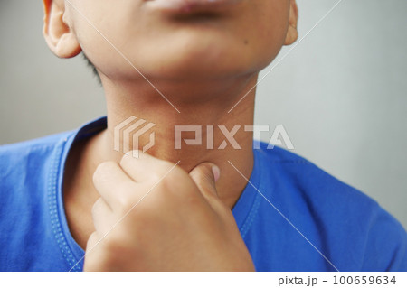 unrecognized man suffering throat pain close up unrecognized man suffering throat pain close up 100659634