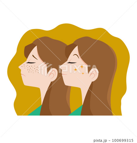 顔のそばかすに悩む女性 100699315