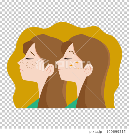 顔のそばかすに悩む女性 100699315