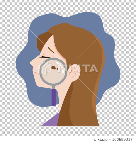 woman suffering from skin blemishes woman suffering from skin blemishes 100699317