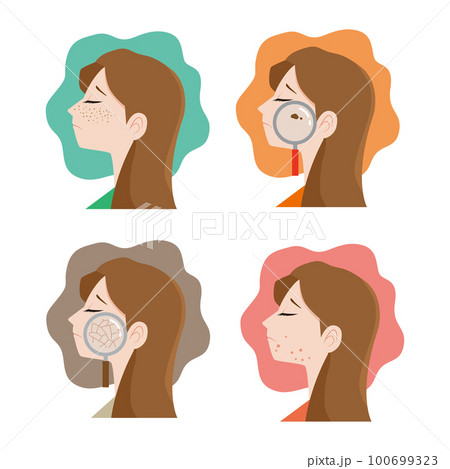 女性の横顔　肌のトラブルイラストセット 100699323