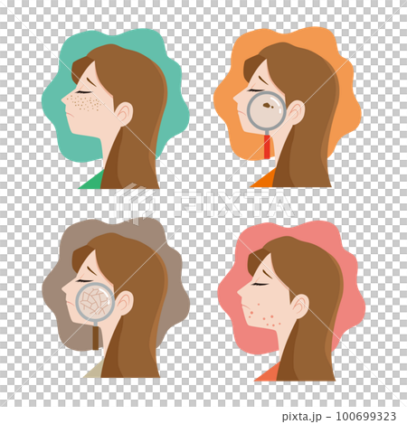 女性の横顔　肌のトラブルイラストセット 100699323