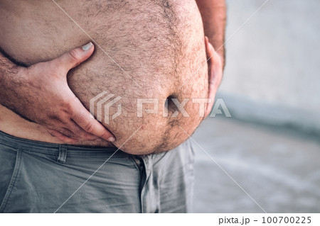 Close-up of a man's round and full hairy belly, with both hands holding it up Close-up of a man's round and full hairy belly, with both hands holding it up 100700225