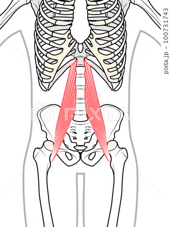 大腰筋　体表あり 100731743