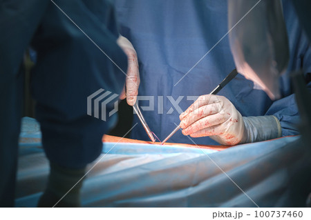 Team of professional doctors operating a patient conducting open cut surgery in surgical room. Healthcare and medical intervention concept Team of professional doctors operating a patient conducting open cut surgery in surgical room. Healthcare and medical intervention concept 100737460