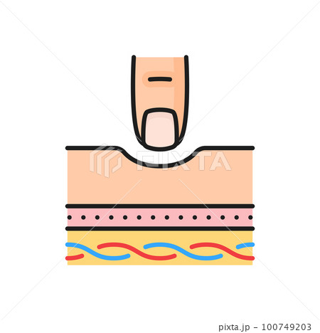 Abnormal blood flow, thrombosis and cardiovascular disease color line icon. Vector finger on skin with edema or swelling body Abnormal blood flow, thrombosis and cardiovascular disease color line icon. Vector finger on skin with edema or swelling body 100749203