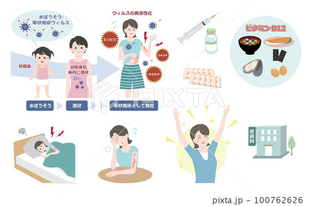 3人に1人が発症するといわれている、帯状疱疹に関するイラストセット（若い女性） 100762626