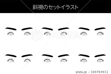 医療イラスト、眼病・斜視の図解セットイラスト 100764911