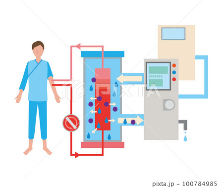 人工透析治療のイメージイラスト 100784985